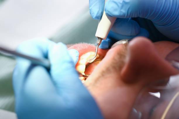 Best Emergency Dental Care for Sports Injuries in Bolindale, OH
